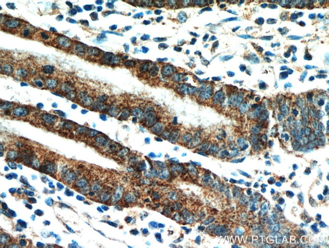 HPDL Antibody in Immunohistochemistry (Paraffin) (IHC (P))