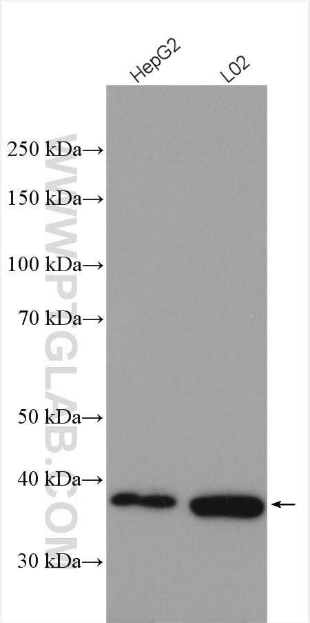 HPDL Antibody in Western Blot (WB)