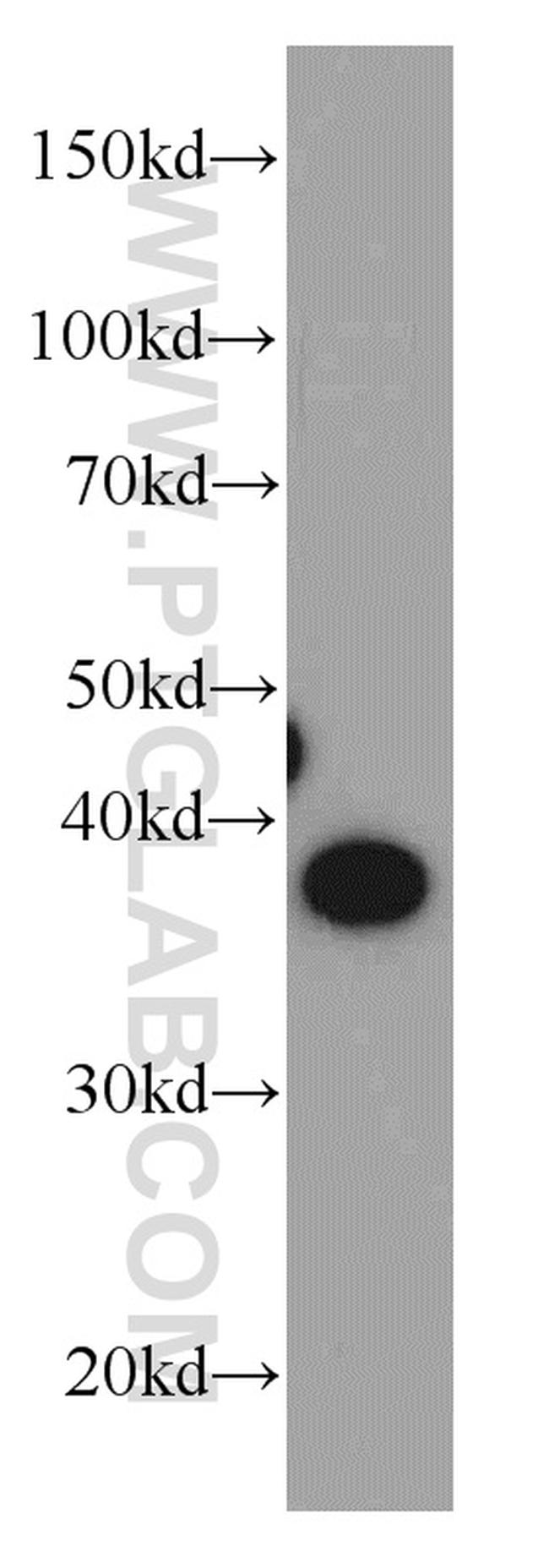 HPDL Antibody in Western Blot (WB)