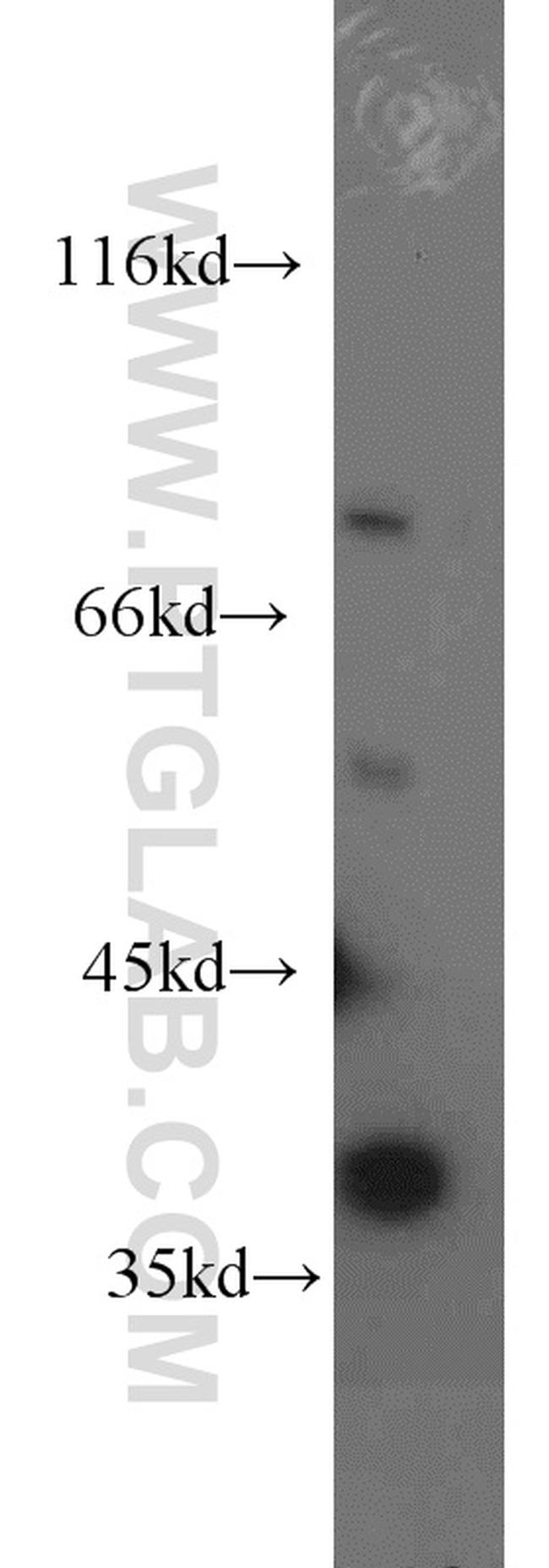 HPDL Antibody in Western Blot (WB)