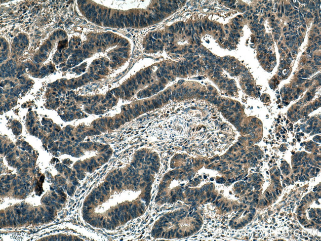 WDR24 Antibody in Immunohistochemistry (Paraffin) (IHC (P))