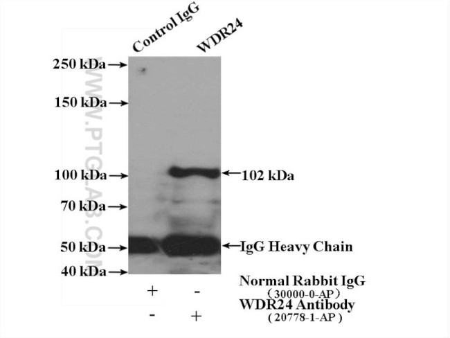 WDR24 Antibody in Immunoprecipitation (IP)