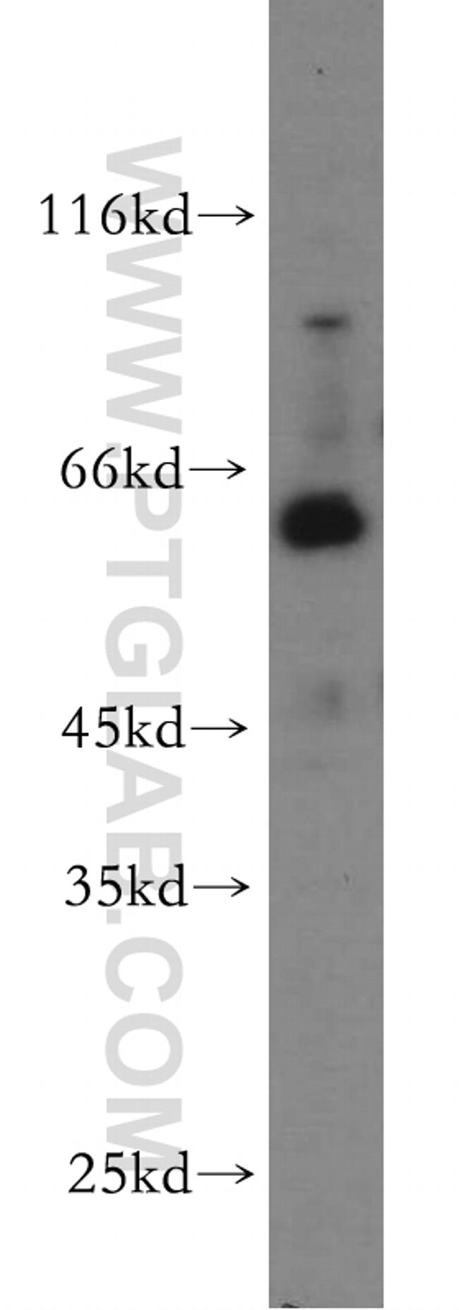 WDR24 Antibody in Western Blot (WB)