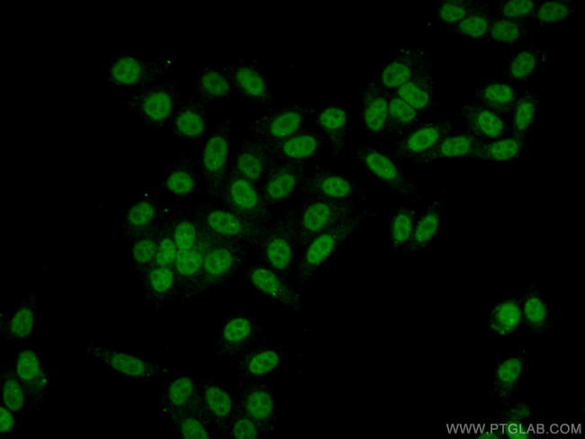 WDR55 Antibody in Immunocytochemistry (ICC/IF)