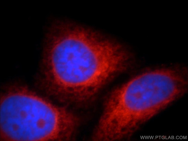 WDR55 Antibody in Immunocytochemistry (ICC/IF)