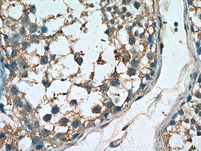 SMO Antibody in Immunohistochemistry (Paraffin) (IHC (P))