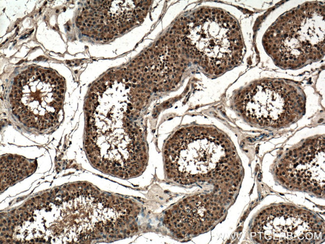 CLASP1 Antibody in Immunohistochemistry (Paraffin) (IHC (P))