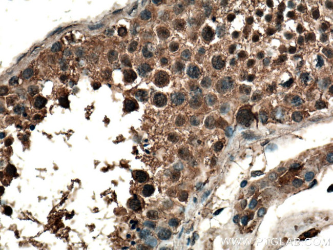 CLASP1 Antibody in Immunohistochemistry (Paraffin) (IHC (P))