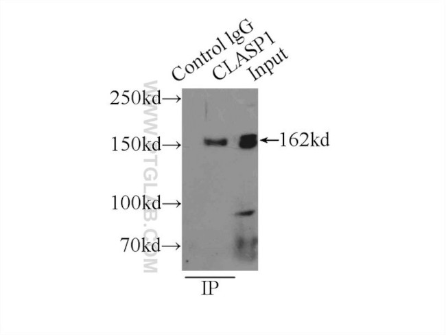 CLASP1 Antibody in Immunoprecipitation (IP)