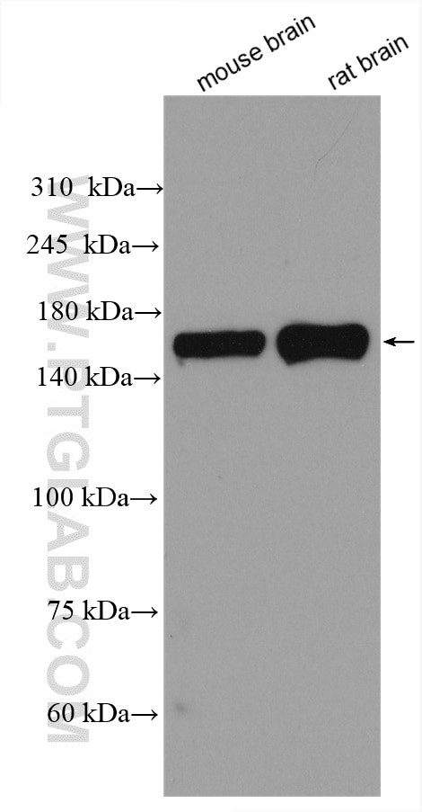CLASP1 Antibody in Western Blot (WB)