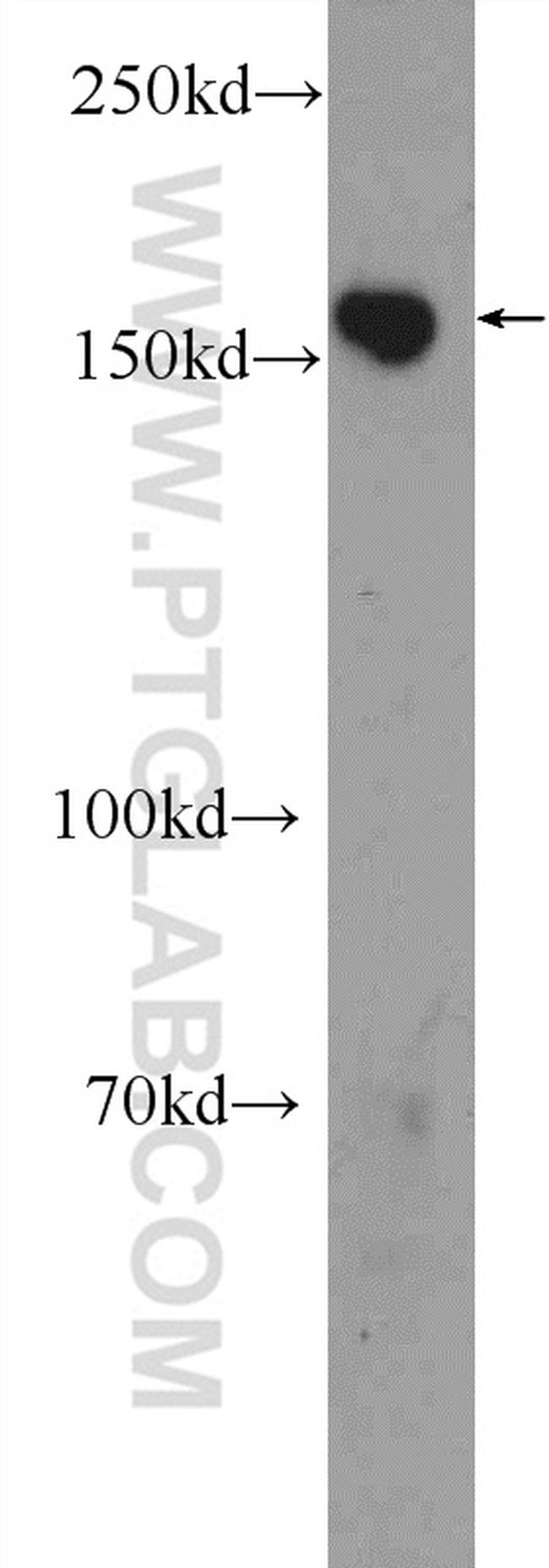 CLASP1 Antibody in Western Blot (WB)