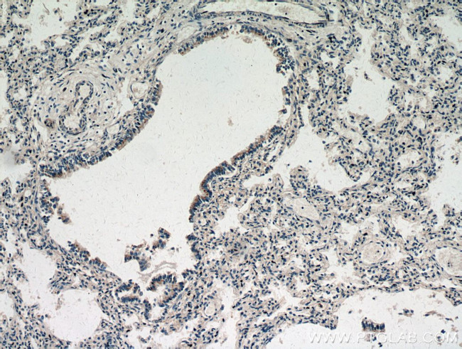 ZNF622 Antibody in Immunohistochemistry (Paraffin) (IHC (P))