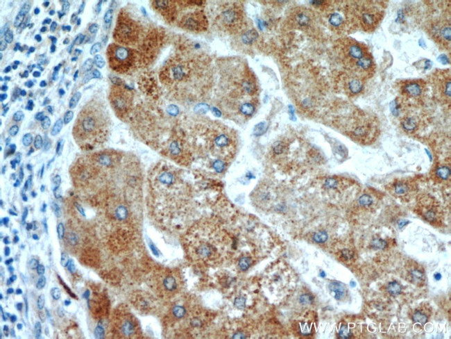 ZNF622 Antibody in Immunohistochemistry (Paraffin) (IHC (P))