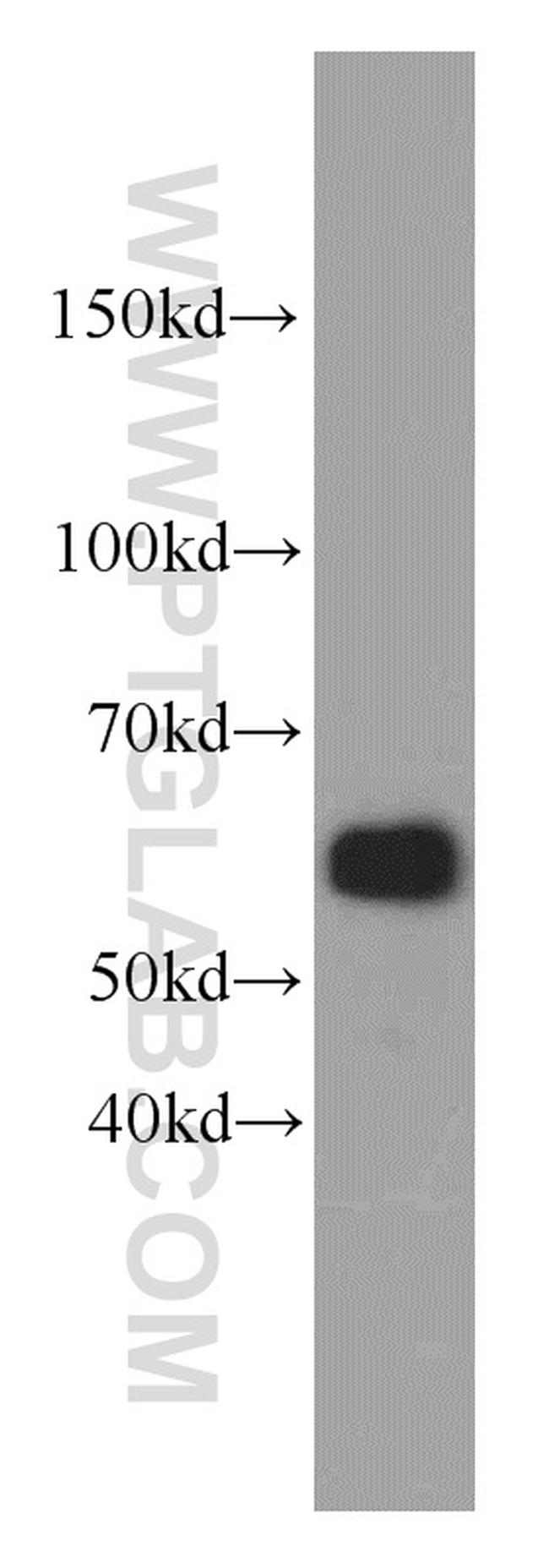 ZNF622 Antibody in Western Blot (WB)