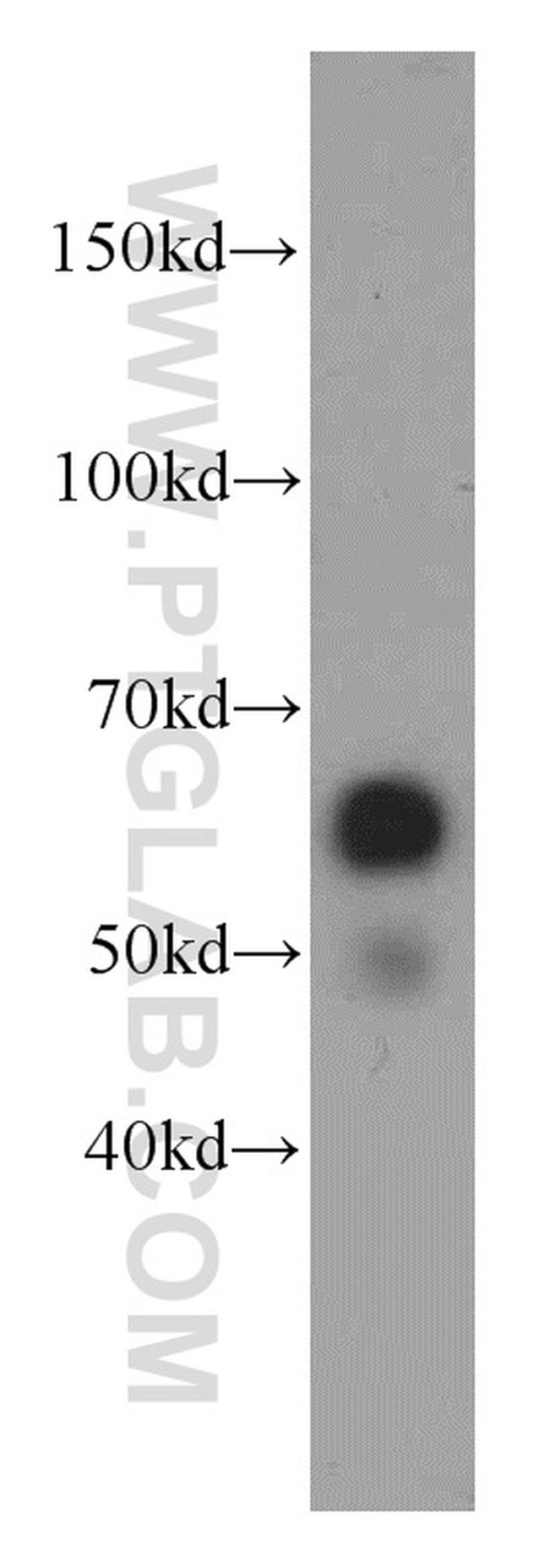 ZNF622 Antibody in Western Blot (WB)