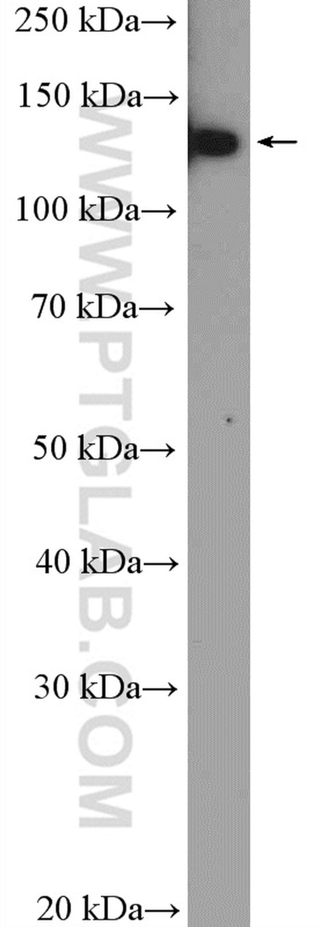 HTATSF1 Antibody in Western Blot (WB)