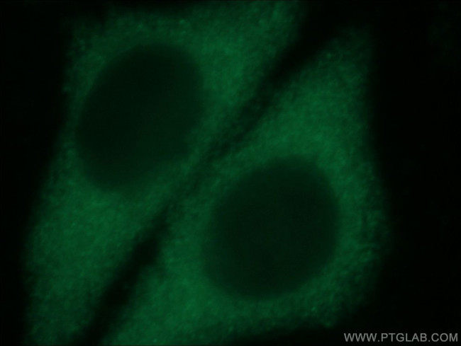 TXNDC17 Antibody in Immunocytochemistry (ICC/IF)