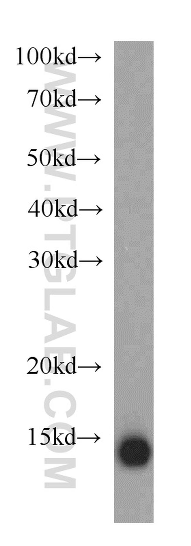 TXNDC17 Antibody in Western Blot (WB)