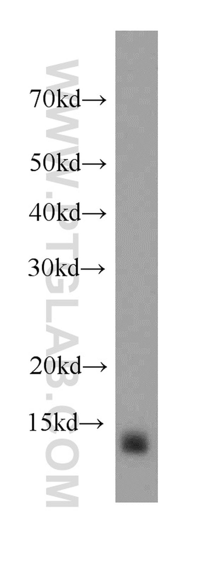 TXNDC17 Antibody in Western Blot (WB)