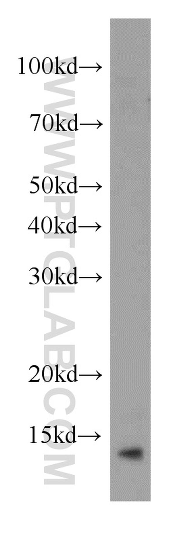 TXNDC17 Antibody in Western Blot (WB)