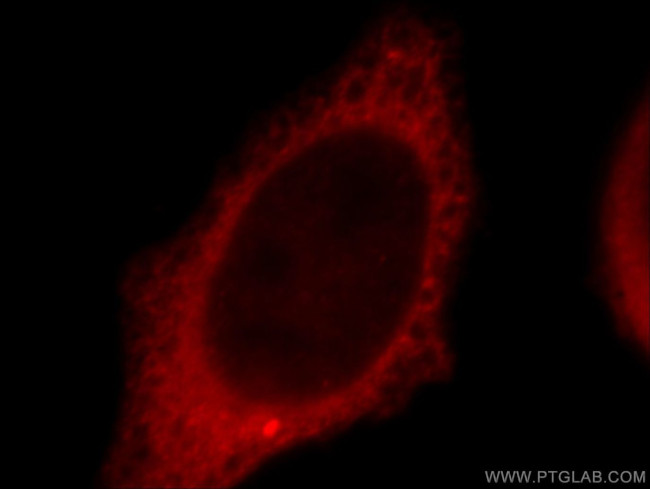 TXNDC17 Antibody in Immunocytochemistry (ICC/IF)