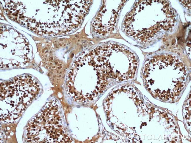 KDM1 Antibody in Immunohistochemistry (Paraffin) (IHC (P))