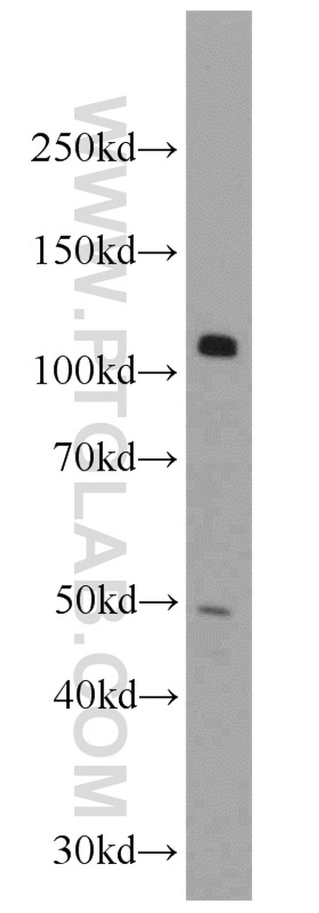 KDM1 Antibody in Western Blot (WB)