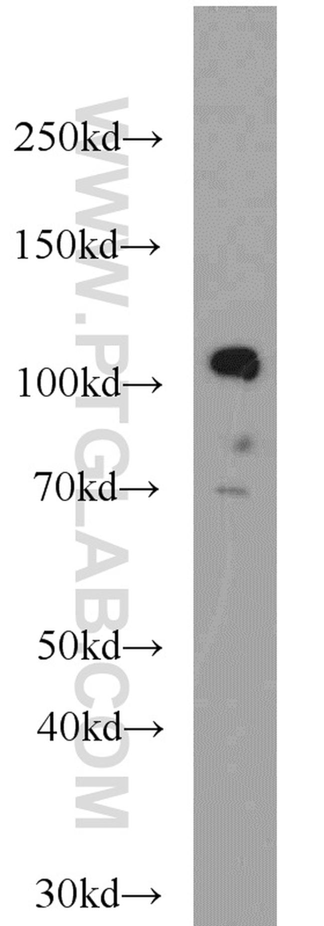 KDM1 Antibody in Western Blot (WB)