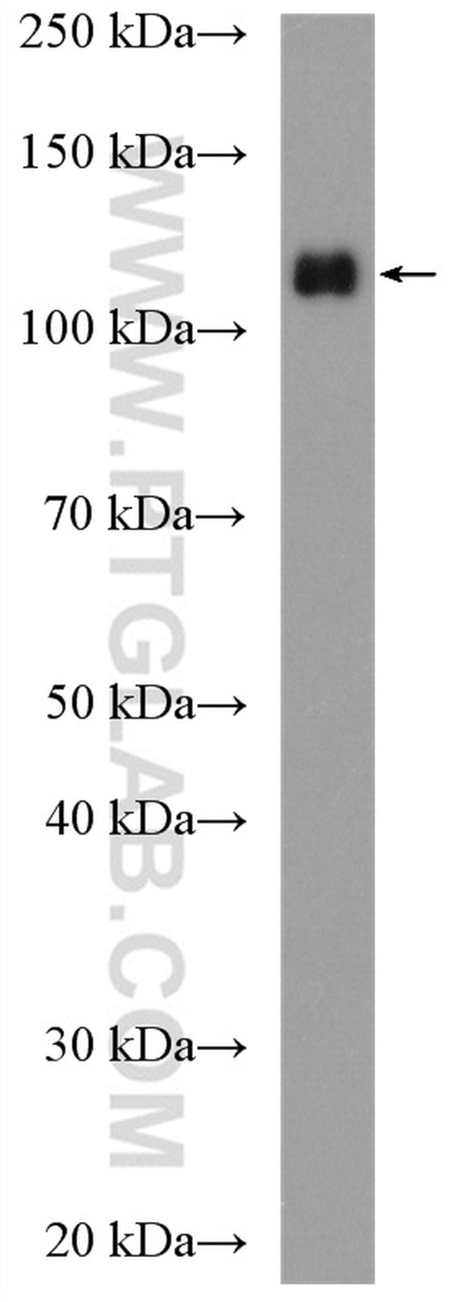 KDM1 Antibody in Western Blot (WB)