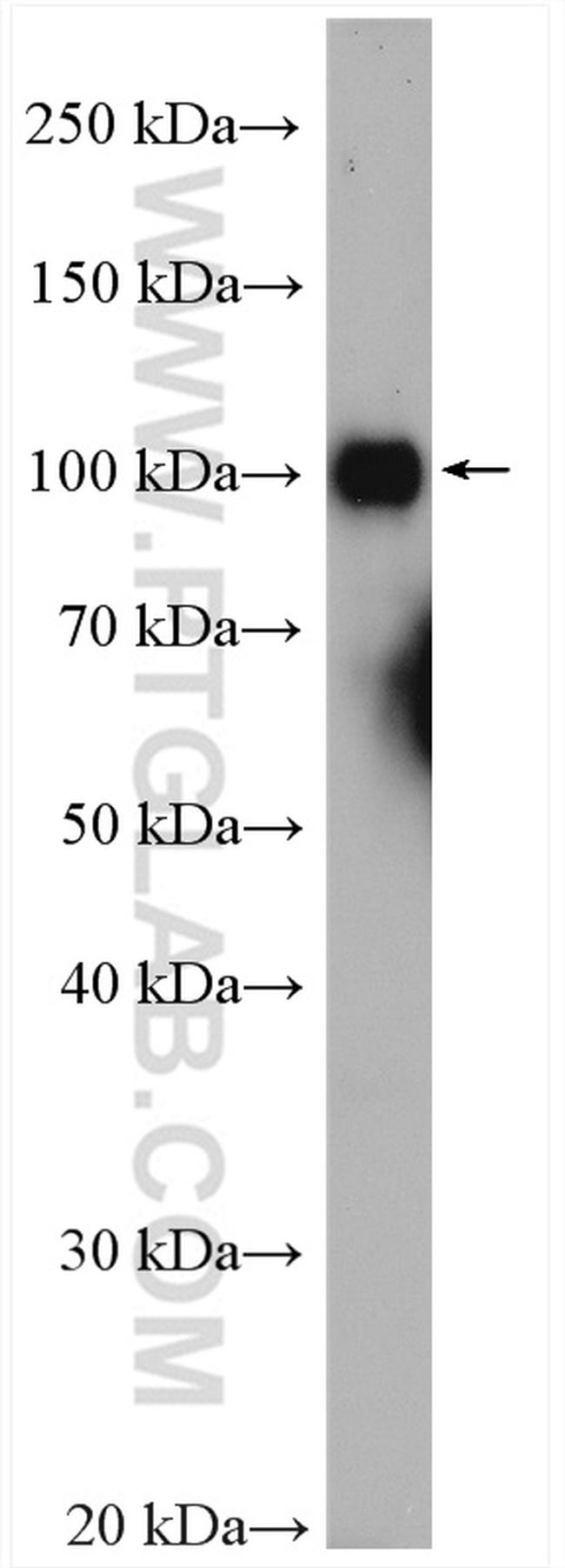 KDM1 Antibody in Western Blot (WB)