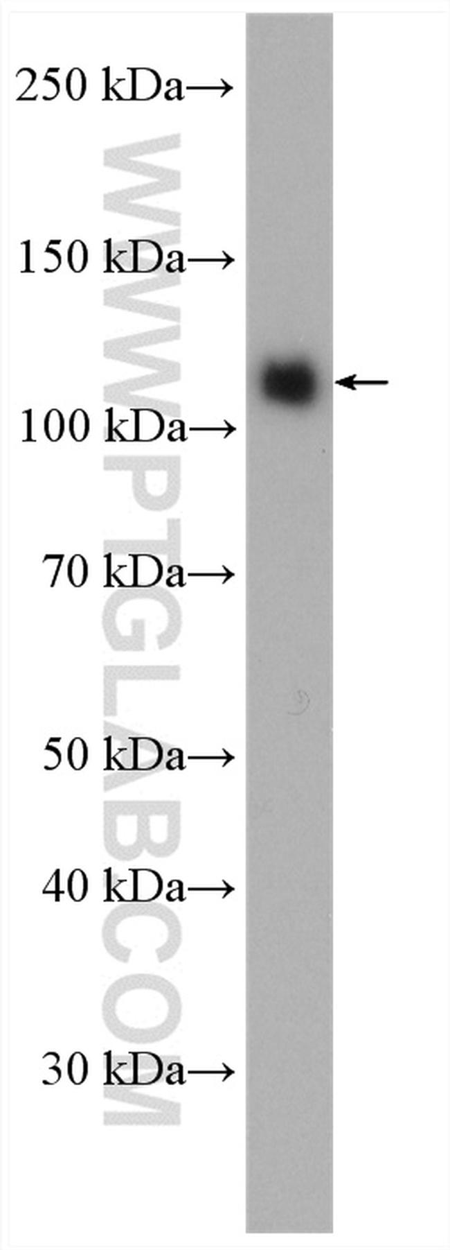 KDM1 Antibody in Western Blot (WB)