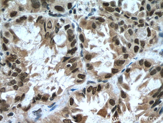 KDM1 Antibody in Immunohistochemistry (Paraffin) (IHC (P))