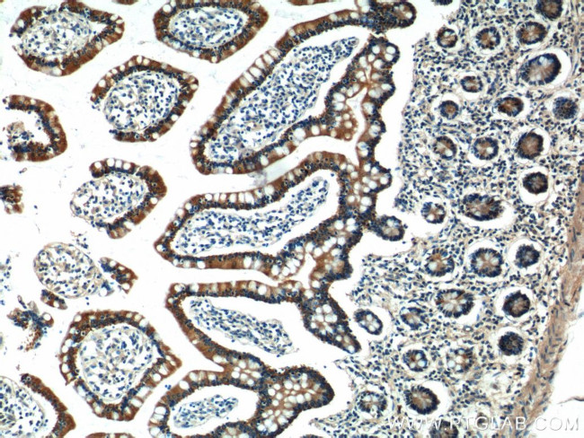 KAZALD1 Antibody in Immunohistochemistry (Paraffin) (IHC (P))