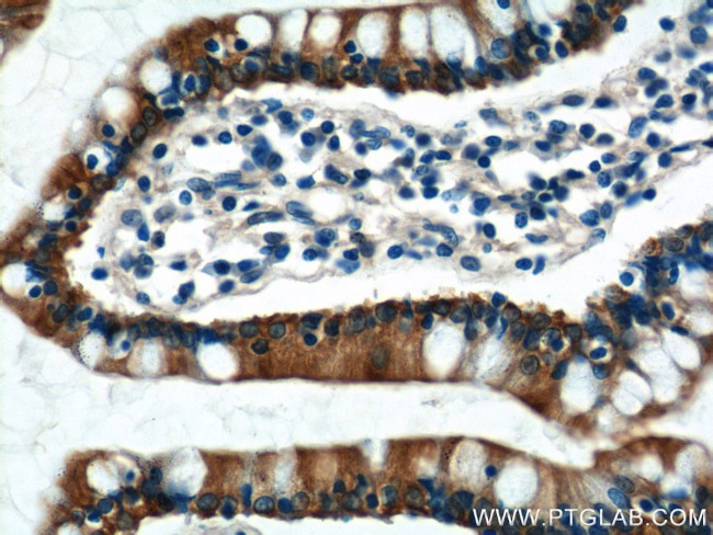 KAZALD1 Antibody in Immunohistochemistry (Paraffin) (IHC (P))