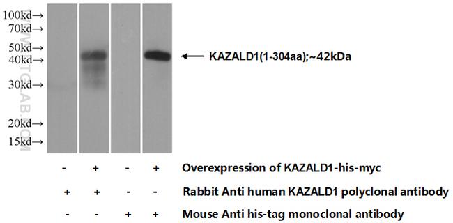 KAZALD1 Antibody in Western Blot (WB)