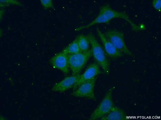SGSM3 Antibody in Immunocytochemistry (ICC/IF)