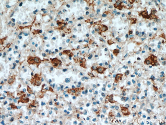 SGSM3 Antibody in Immunohistochemistry (Paraffin) (IHC (P))