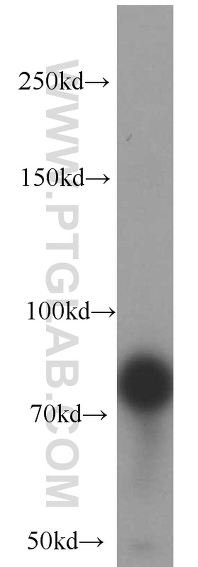 SGSM3 Antibody in Western Blot (WB)