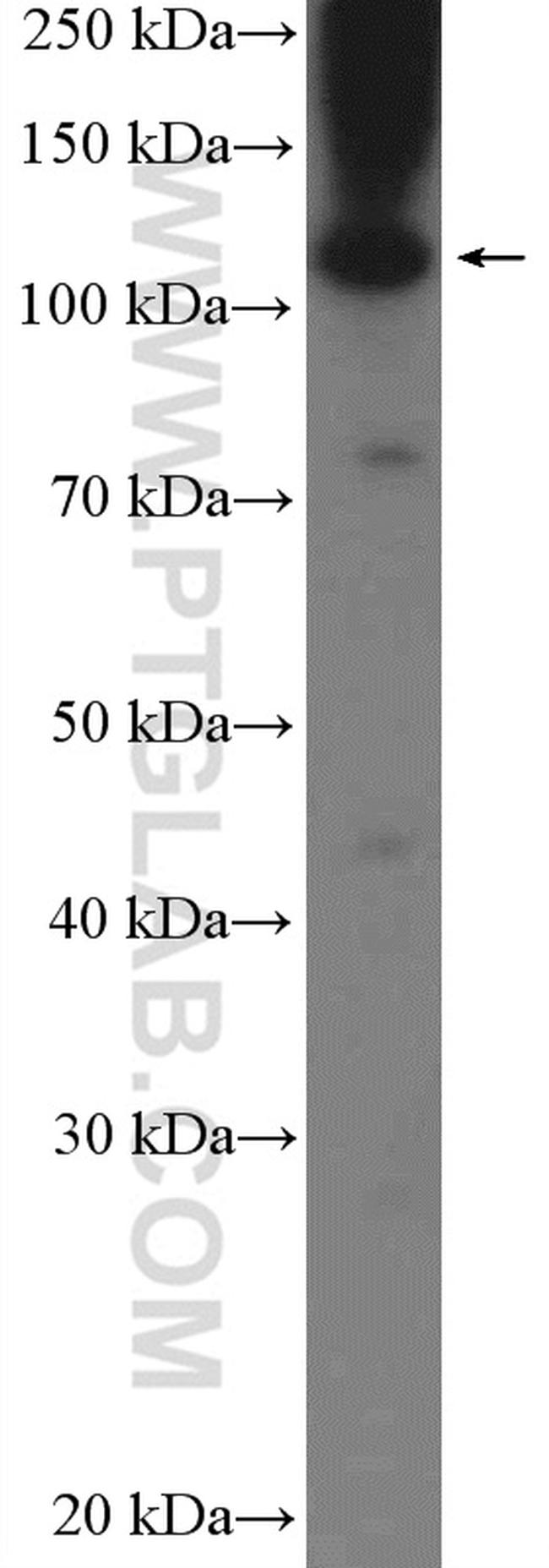 C9orf86 Antibody in Western Blot (WB)
