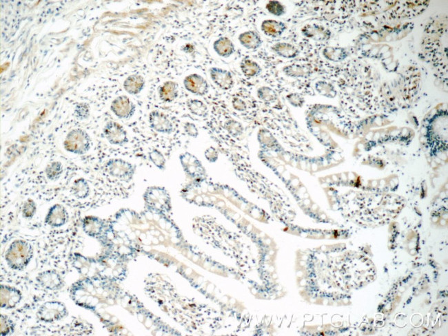 DAX-1 Antibody in Immunohistochemistry (Paraffin) (IHC (P))