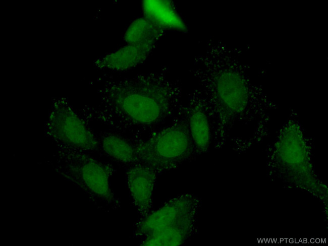 DAX-1 Antibody in Immunocytochemistry (ICC/IF)