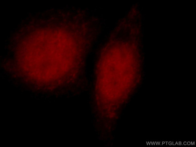 NSUN2 Antibody in Immunocytochemistry (ICC/IF)