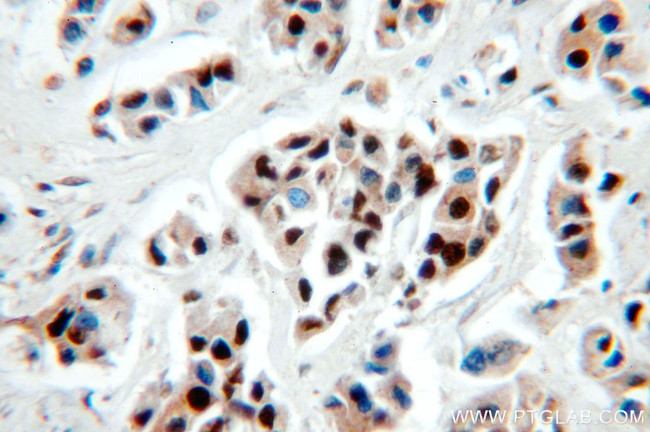 NSUN2 Antibody in Immunohistochemistry (Paraffin) (IHC (P))