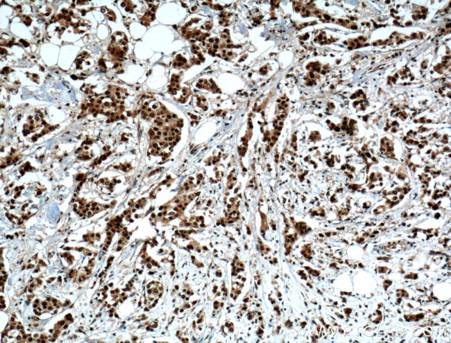 NSUN2 Antibody in Immunohistochemistry (Paraffin) (IHC (P))