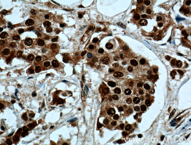 NSUN2 Antibody in Immunohistochemistry (Paraffin) (IHC (P))