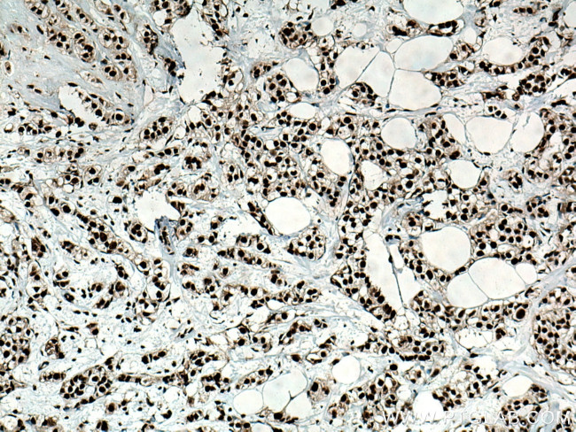 NSUN2 Antibody in Immunohistochemistry (Paraffin) (IHC (P))