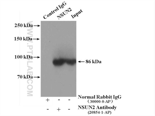 NSUN2 Antibody in Immunoprecipitation (IP)