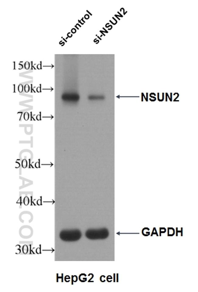 NSUN2 Antibody in Western Blot (WB)