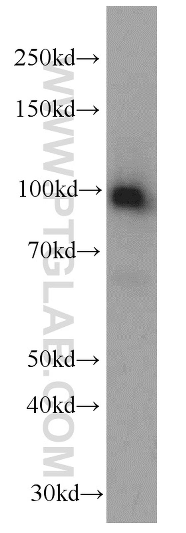 NSUN2 Antibody in Western Blot (WB)