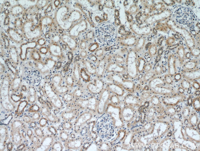 SLC38A4 Antibody in Immunohistochemistry (Paraffin) (IHC (P))